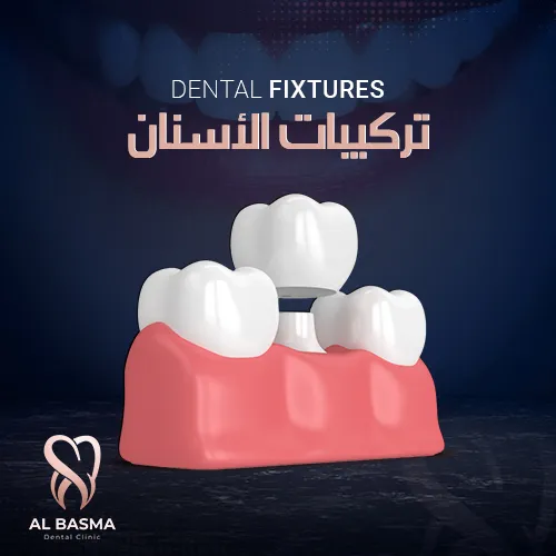 تركيبات الأسنان