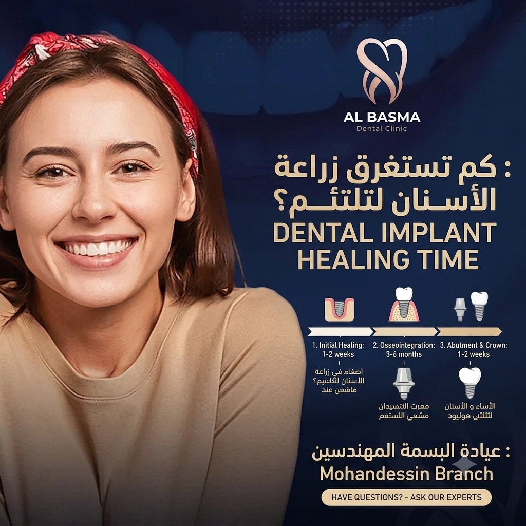 كم تستغرق زراعة الأسنان لتلتئم؟ | عيادة البسمة المهندسين